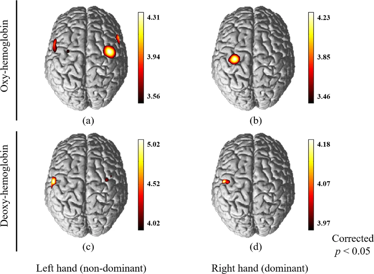 Brain activation maps showing differential cortical responses for dominant (right) and non-dominant (left) hands measured using oxy- and deoxy-hemoglobin signals with significant motor cortex lateralization